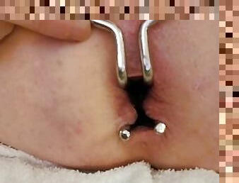 Stretched open with an anal speculum