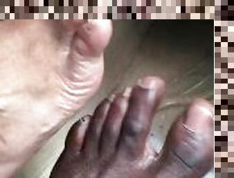 Tasty toes and big sore bunion feet