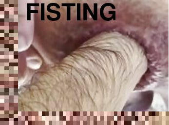 1 Small Dick 1 Extreme Punch Fisting until Anal Gape - Part 1