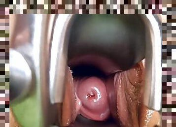 Speculum opening big pussy and cervix inspection (teaser)